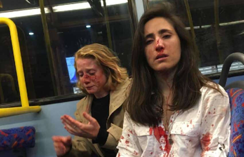 Chris (L) and Melania after the London bus attack. They're covered in blood.